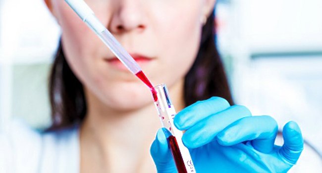 анализ крови на онкомаркеры