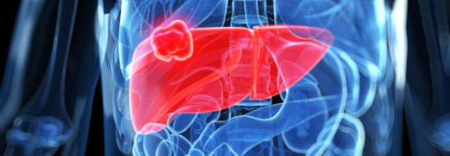 печень с раком