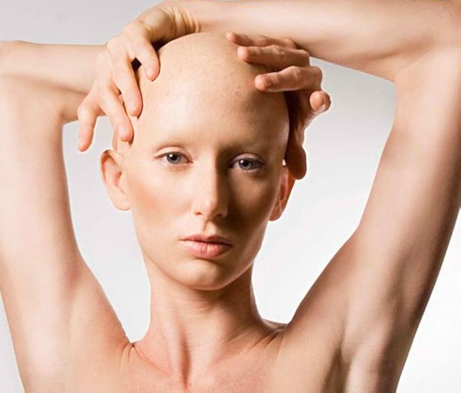 женщина с онкологией без волос