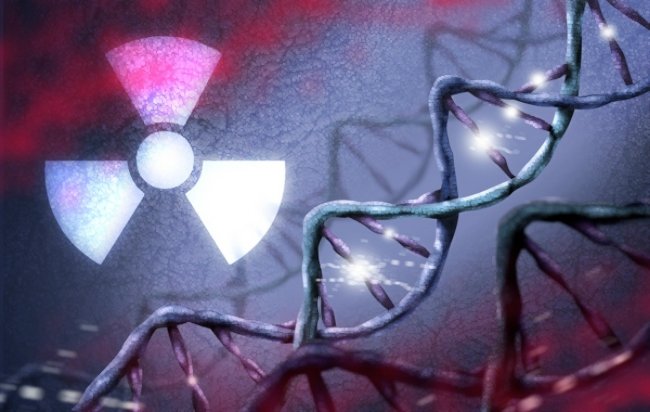 лучевая терапия