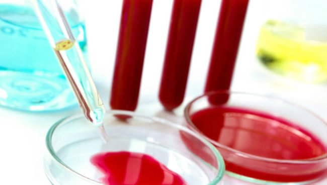 лейкоз крови