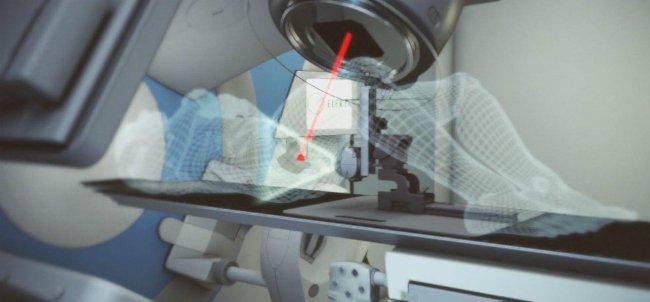 преимущества лучевой терапии