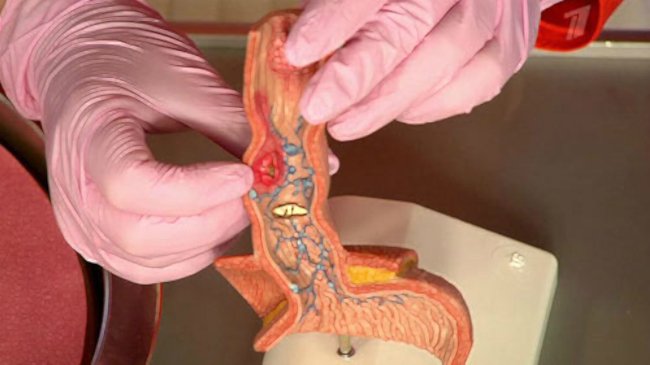 можно ли заразится раком крови