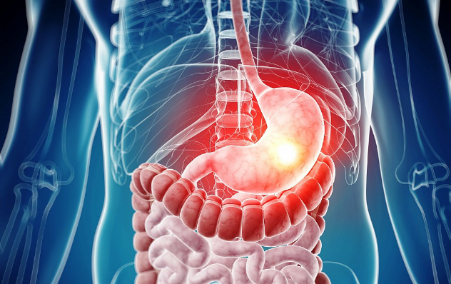 malt лимфома желудка графика