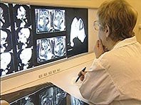 Необычный метод позволит выявить рак на ранней стадии Необычный метод позволит выявить рак на ранней стадии