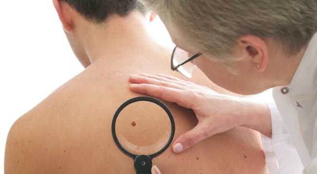 осмотр у онколога