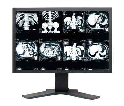 как правильно подготовиться к мрт малого таза