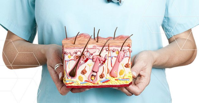 лимфосаркома модель