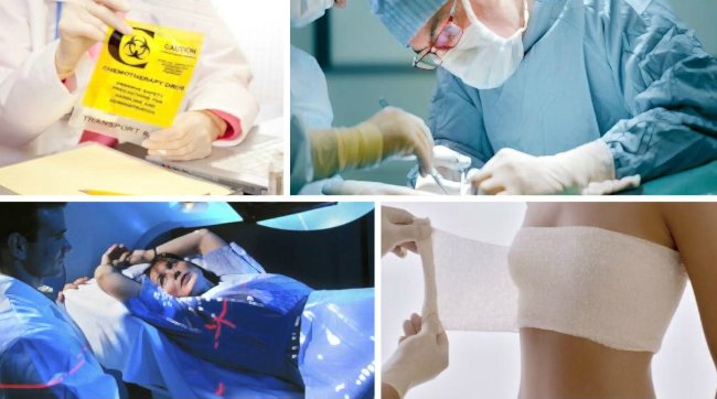 лечение саркомы рака груди