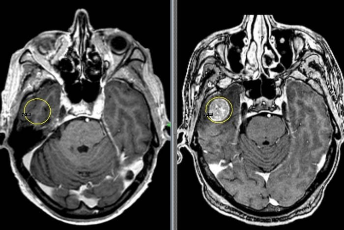 Рентген головы