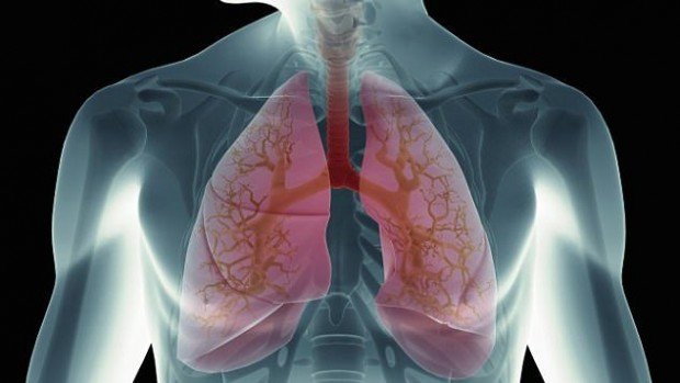 Пациенты с раком легких чаще совершают самоубийство Пациенты с раком легких чаще совершают самоубийство