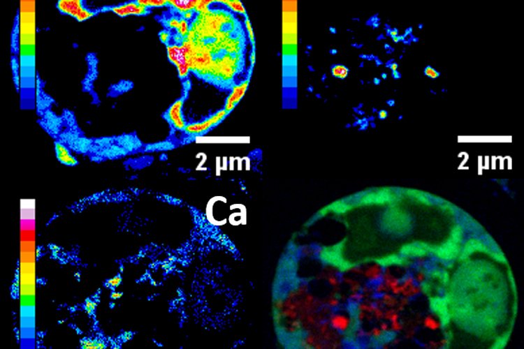 Новый препарат уничтожает раковые клетки изнутри