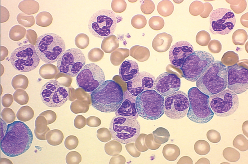 Под микроскопом