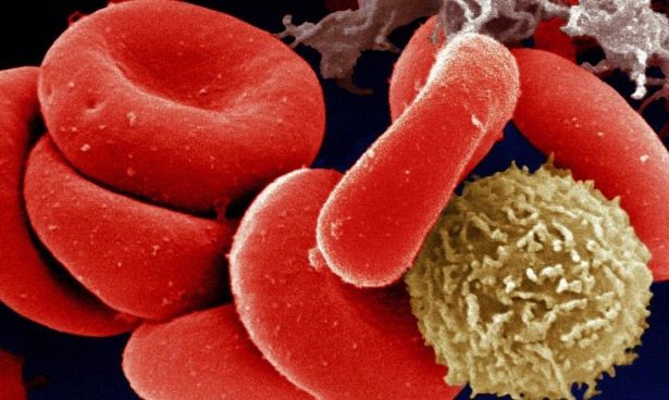 Прием варфарина обеспечивает защиту от опухолей