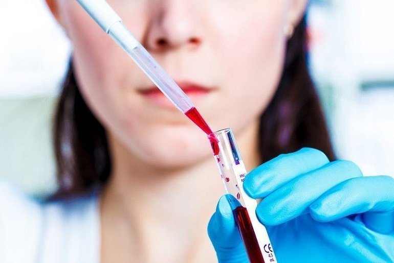 Нейронспецифическая енолаза онкомаркер что означает. Смотреть фото Нейронспецифическая енолаза онкомаркер что означает. Смотреть картинку Нейронспецифическая енолаза онкомаркер что означает. Картинка про Нейронспецифическая енолаза онкомаркер что означает. Фото Нейронспецифическая енолаза онкомаркер что означает