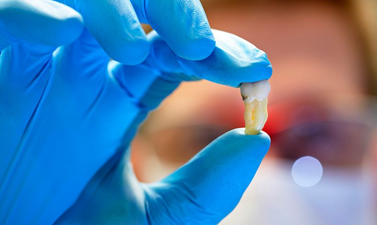 Если есть проблемы с зубами