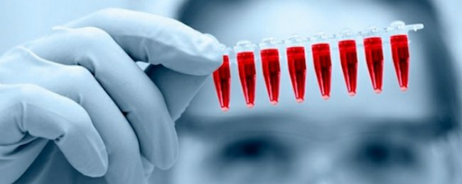 анализы крови на Cyfra 21-1