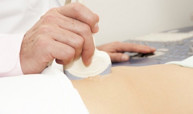 УЗИ яичников