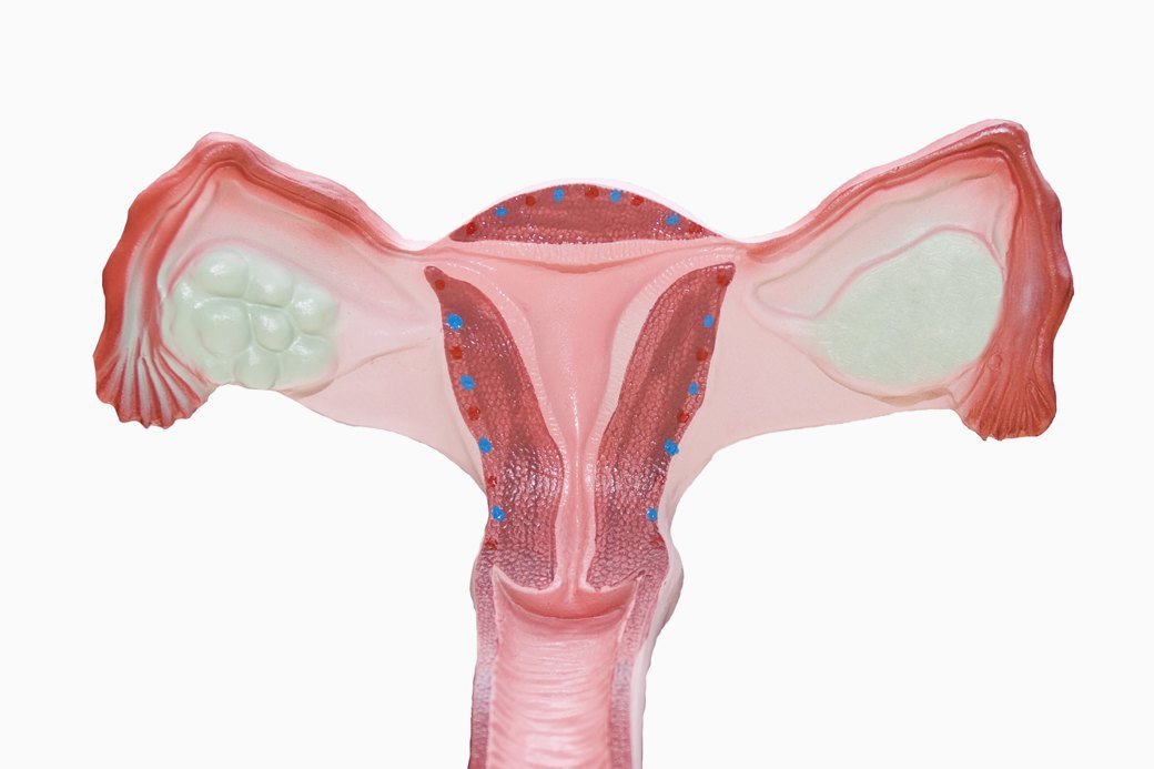 Онкомаркер СА 125