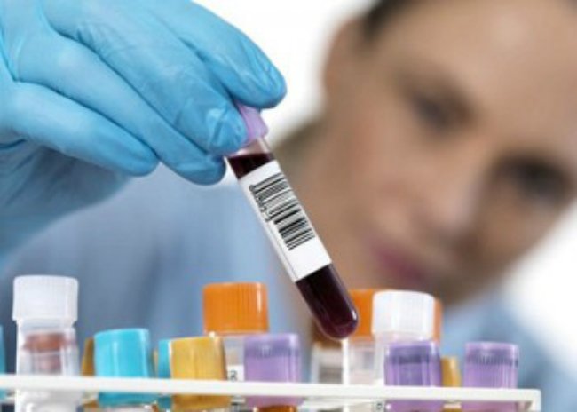 анализ на цитокератин 