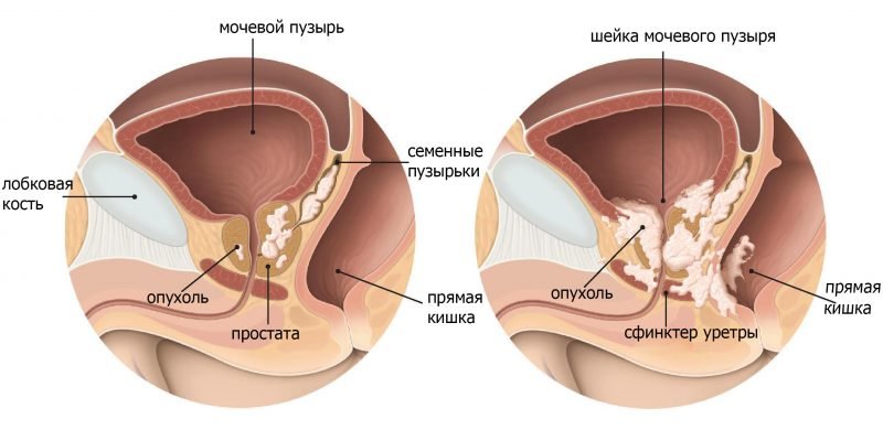Заболевание